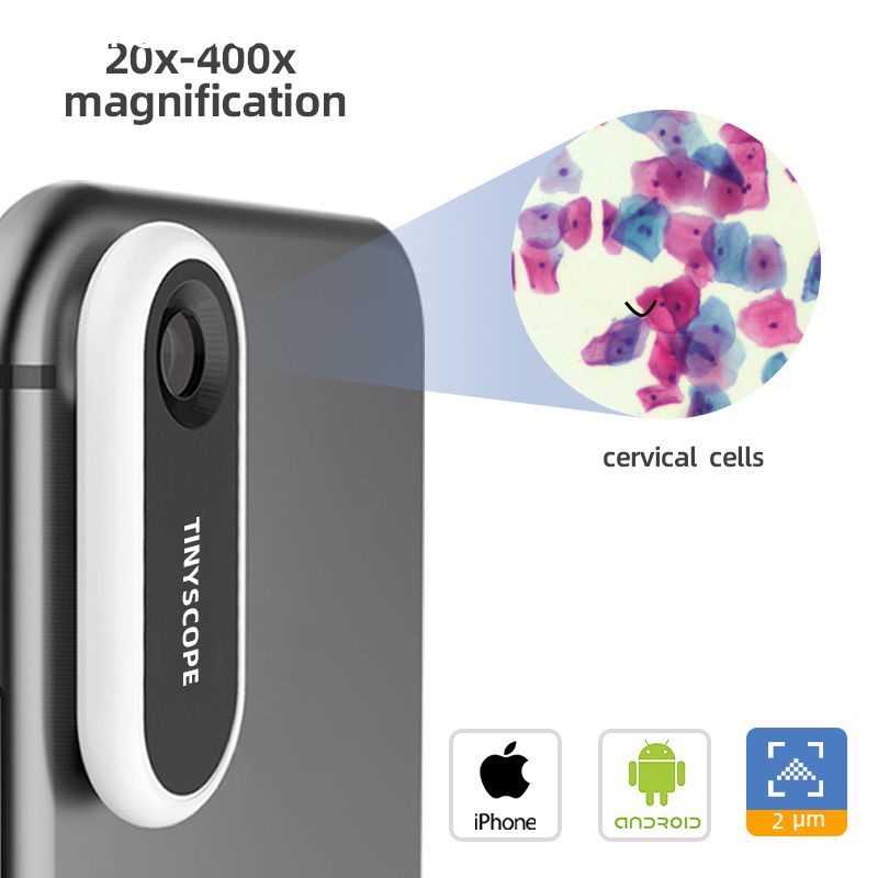 Ống Kính Hiển Vi 20x-400x Hd Chuyên Nghiệp Cho Điện Thoại Iphone Xiaomi Samsung Huawei Imercado