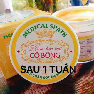 Kem tan mỡ Cô Bông