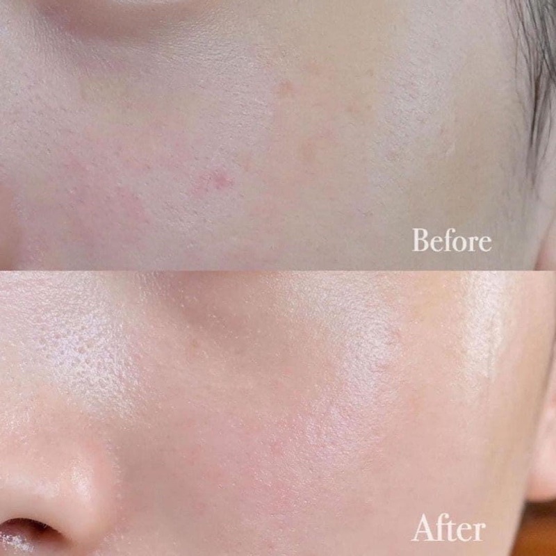 GEL DƯỠNG ẨM CLINIQUE DRAMATICALLY DIFERENT MOISTURIZING GEL 125ML