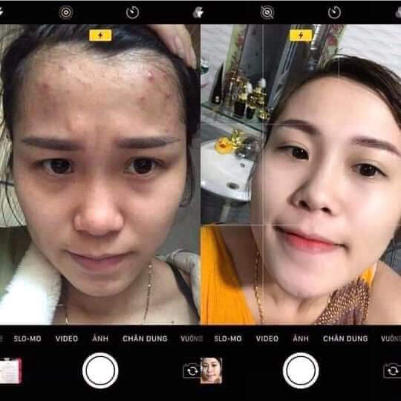 Serum thảo mộc xanh