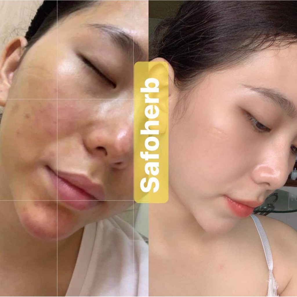 Serum Safoherb 10ml | BigBuy360 - bigbuy360.vn
