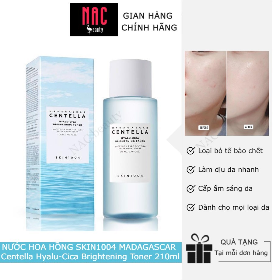 Nước hoa hồng Skin1004 Madagascar Centella Hyalu-Cica Brightening Toner 210ml