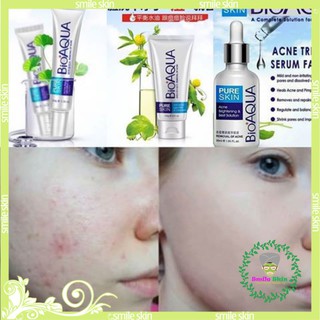 (bộ đôi 1 serum+ kem)bộ đôi Kem ngăn ngừa Mụn Trứng Cá , Giảm Sẹo, Sưng Đỏ BIOAQUA Pure Skin
