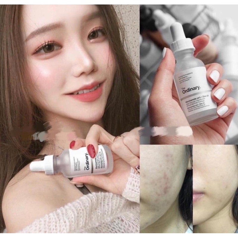 [Mã COS1904 giảm 8% đơn 300K] TINH CHẤT THE ORDINARY NIACINAMIDE 10%+ZINC 1% SERUM