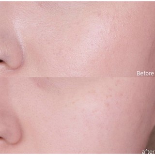 Sữa rửa mặt Biodema Sebium Cleansing