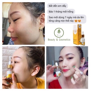 Serum 7day olic (mẫu có tem check)