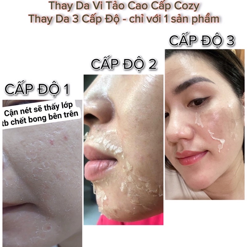 Sỉ 5 chai peel mặt vi tảo