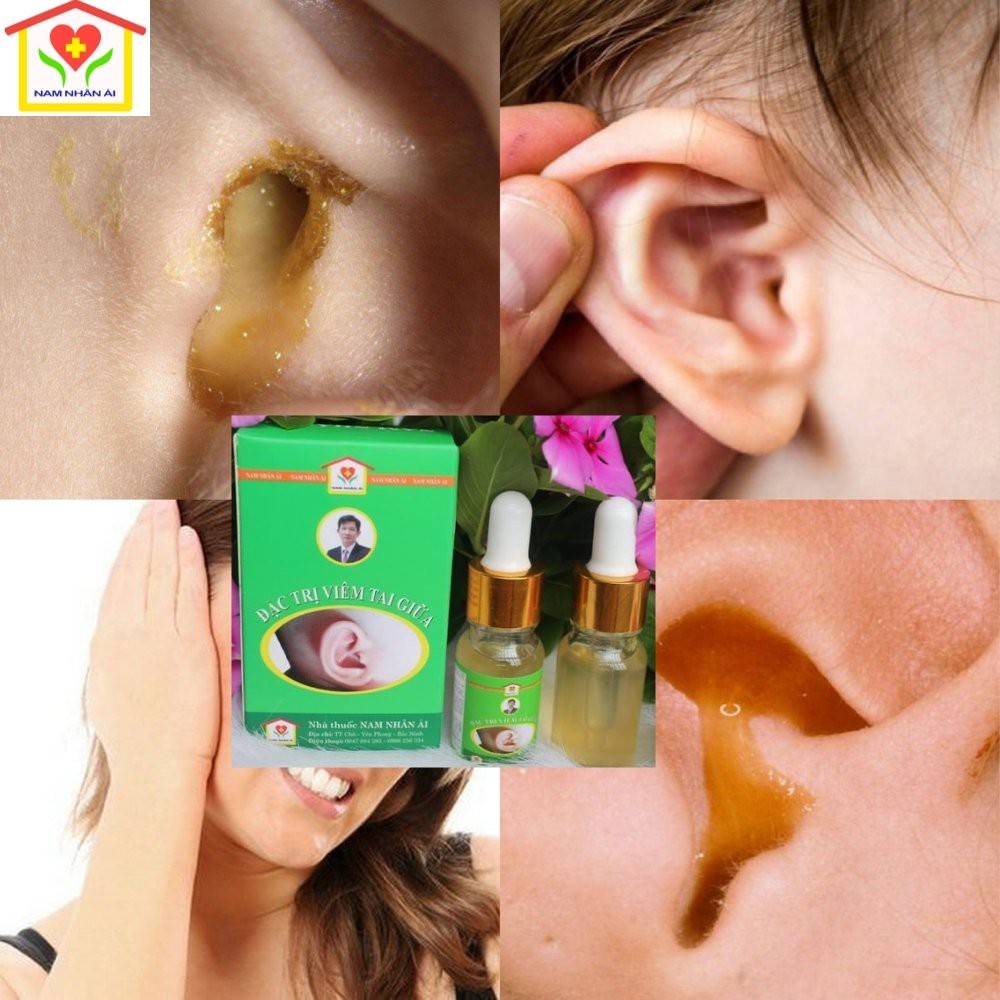Viêm tai giữa trẻ nhỏ, người lớn Ông Lam