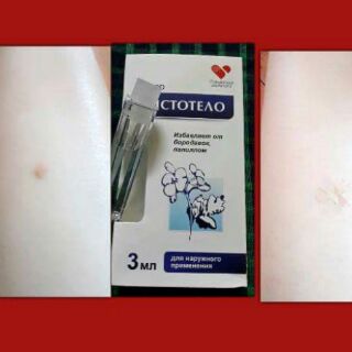 Gel tẩy nốt ruồi