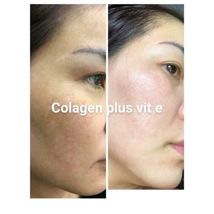 Cam Kết Hàng Chuẩn Kem Ngày Và Đêm Face Collagen Plus Vit E