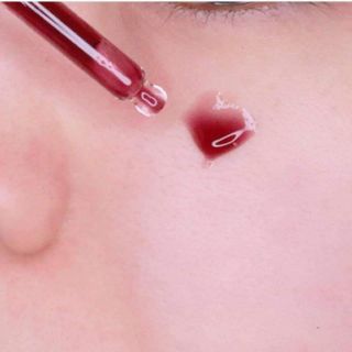 RED PEEL TINGLE SERUM