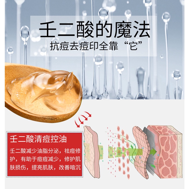 Gel Hỗ trợ giảm mụn DETVFO 20g Làm Sạch Sâu Lỗ Chân Lông Kiểm Soát Dầu Và Làm Sáng Da