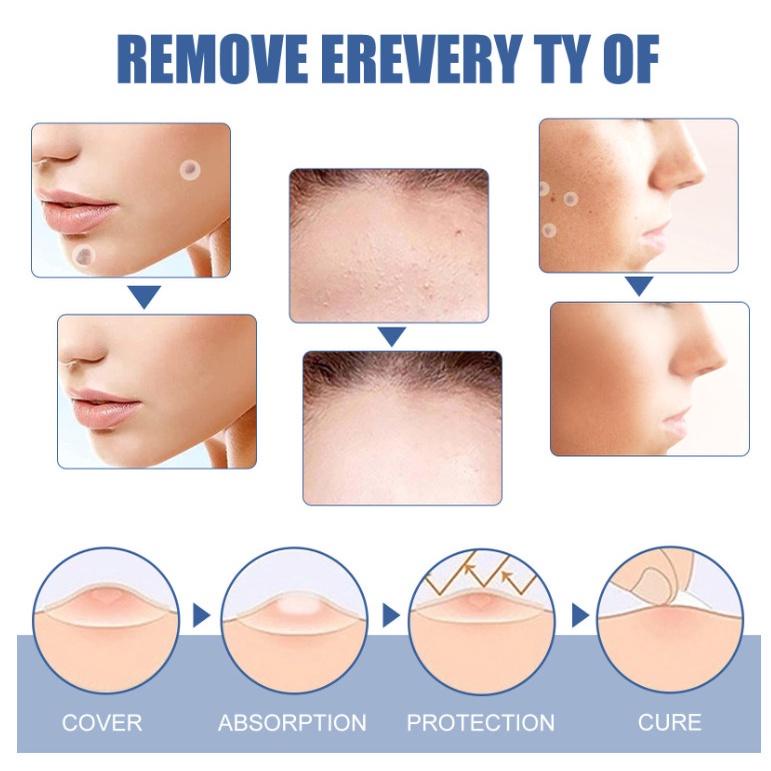 Miếng dán mụn SKIN TAG PATCH, INNIS CARE giảm sưng mụn đầu đen, ruồi, mụn cơm  tái tạo da tự nhiên 144 miếng dán
