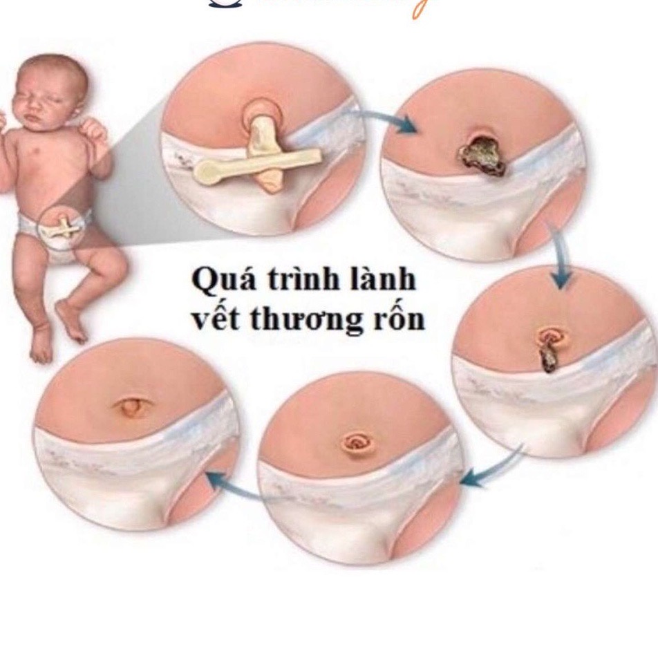 Băng gạc rốn Đông Fa cho bé ( 1 gói )