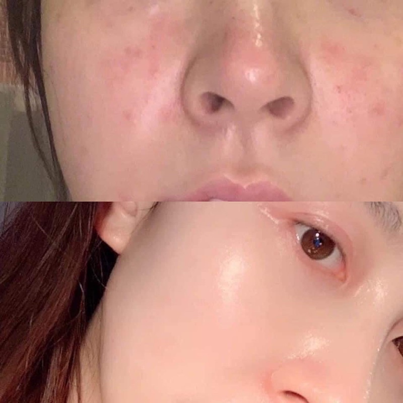 BỘT UỐNG COLLAGEN LỰU ĐỎ BIO CELL HỘP 30 GÓI