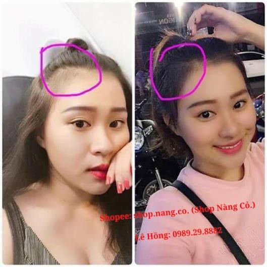 [Chính Hãng] Phân loại Combo Tinh dầu vỏ bưởi, Dầu gội hoa bưởi, Dầu xả dừa, Kích mọc tóc dày dài, Ngăn rụng tóc hói đầu | BigBuy360 - bigbuy360.vn