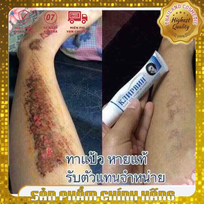 Kem hỗ trợ mờ sẹo mờ thâm, rạn da Klirvin Nga 25G