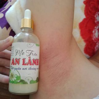 Combo triệt lông An Lành