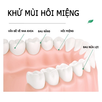 Nước súc miệng Bioaqua gói tiện dụng giảm hôi miệng và sát khuân