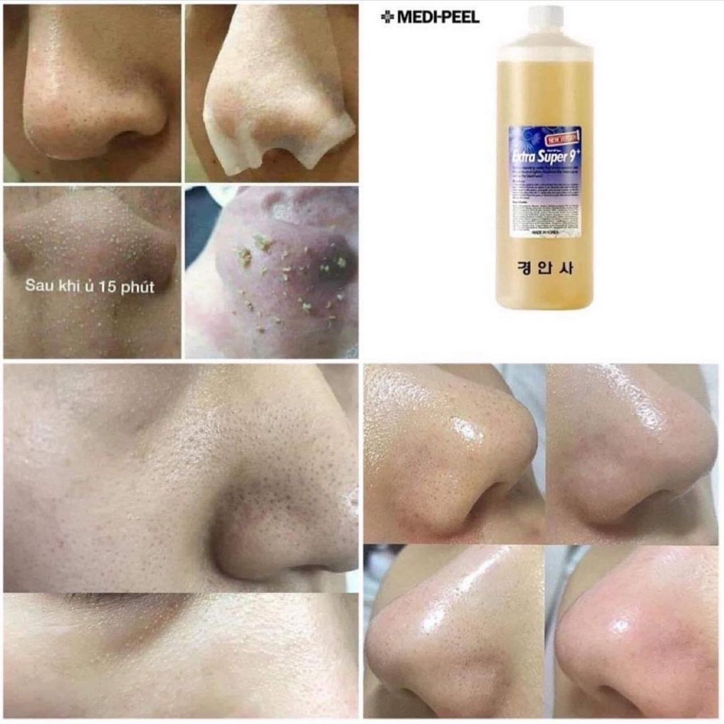 (CHIẾT) DUNG DỊCH LÀM SẠCH VÙNG MŨI MEDIPEEL EXTRA SUPER 9 -50ML/100ML