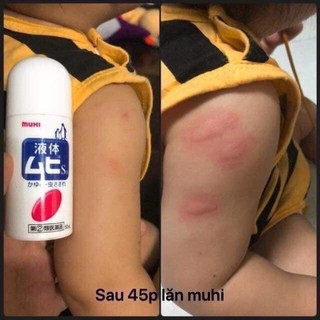Kem lăn muỗi và trị côn trùng cắn MUHI 50ml Nhật Bản