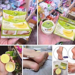 Kem Nứt Gót Chân Chuối Thái Lan