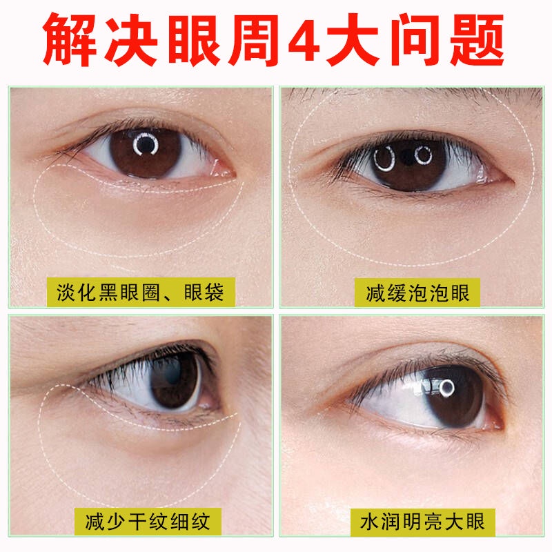 (Hàng Mới Về) Mặt Nạ Mắt Loại Bỏ Quầng Thâm Bọng Mắt Làm Sáng Da | BigBuy360 - bigbuy360.vn