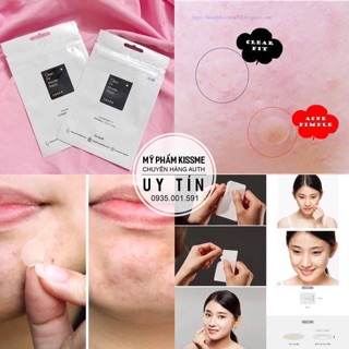 Miếng Dán Mụn Cosrx Clear Fit Master Patch