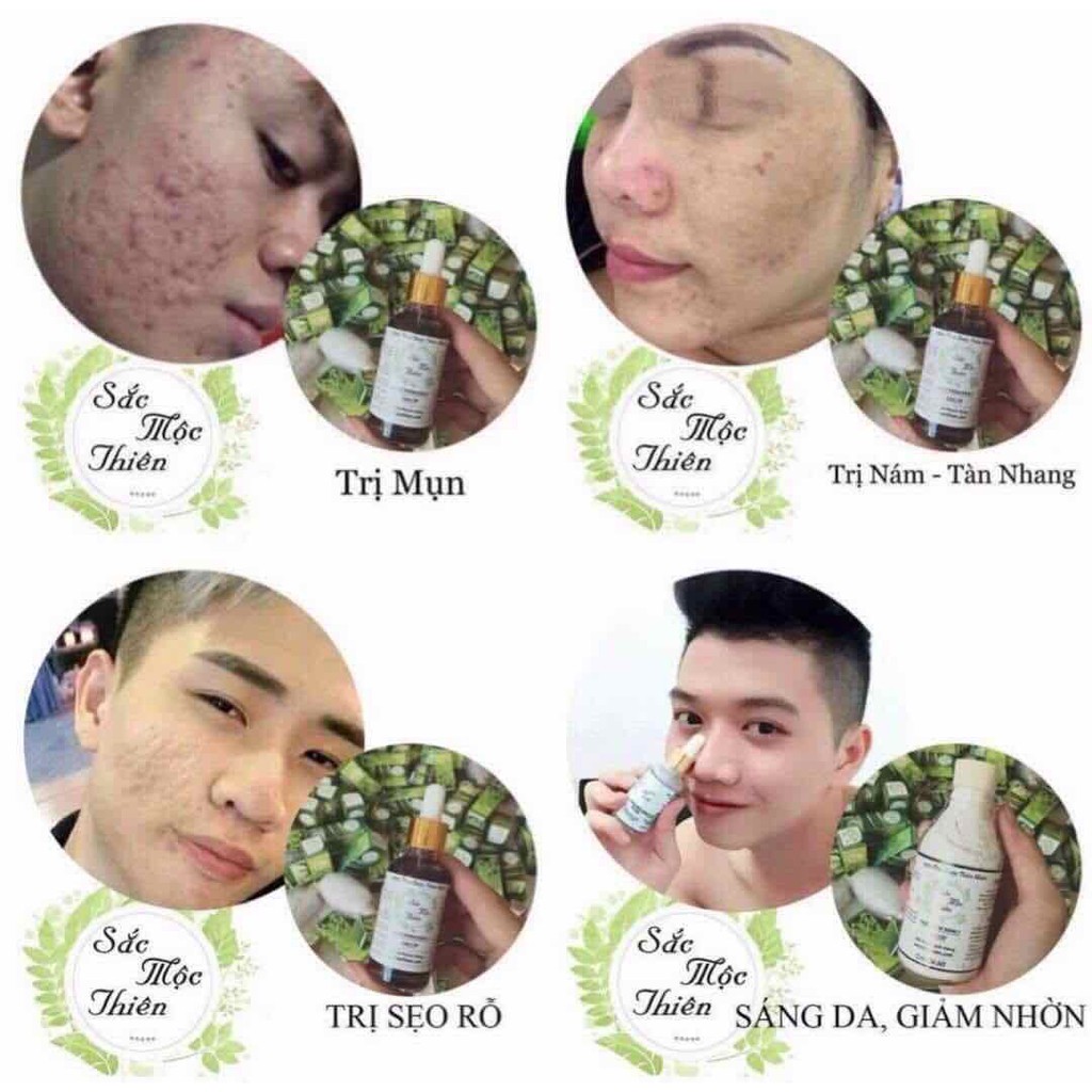 Cải Thiện Mụn, Thâm Nám, Tàn Nhang, Rỗ Tái Tạo Da Sắc Mộc Thiên hàng chuẩn bán Sỉ | BigBuy360 - bigbuy360.vn