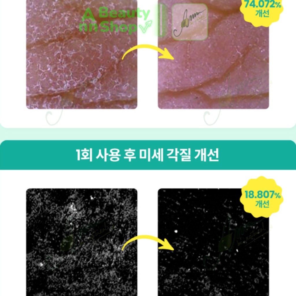 Tẩy Da Chết Dr.G Brightening Peeling Gel