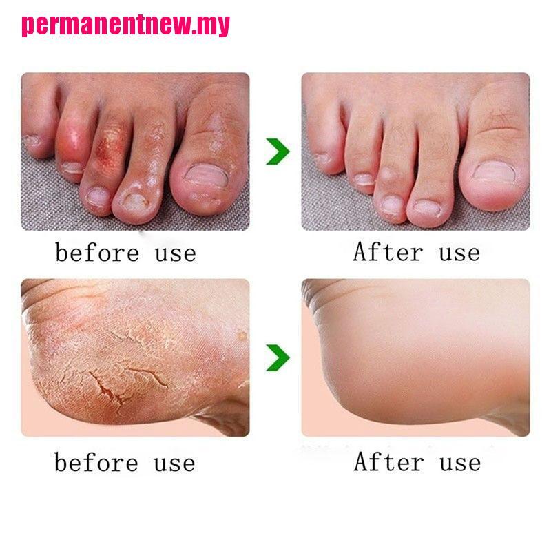 (Hàng Mới Về) Kem Dưỡng Da Chân Chống Khô Và Nứt Nẻ 33g / 85g | BigBuy360 - bigbuy360.vn