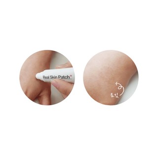 GEL CHE MỤN REAL SKIN PATCH  NOT4