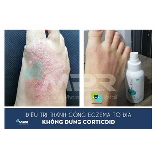 (IB lấy mã) Maxibac Spray và Maxibac gel