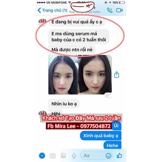 Tinh Chất Làm Đầy Má Miracle