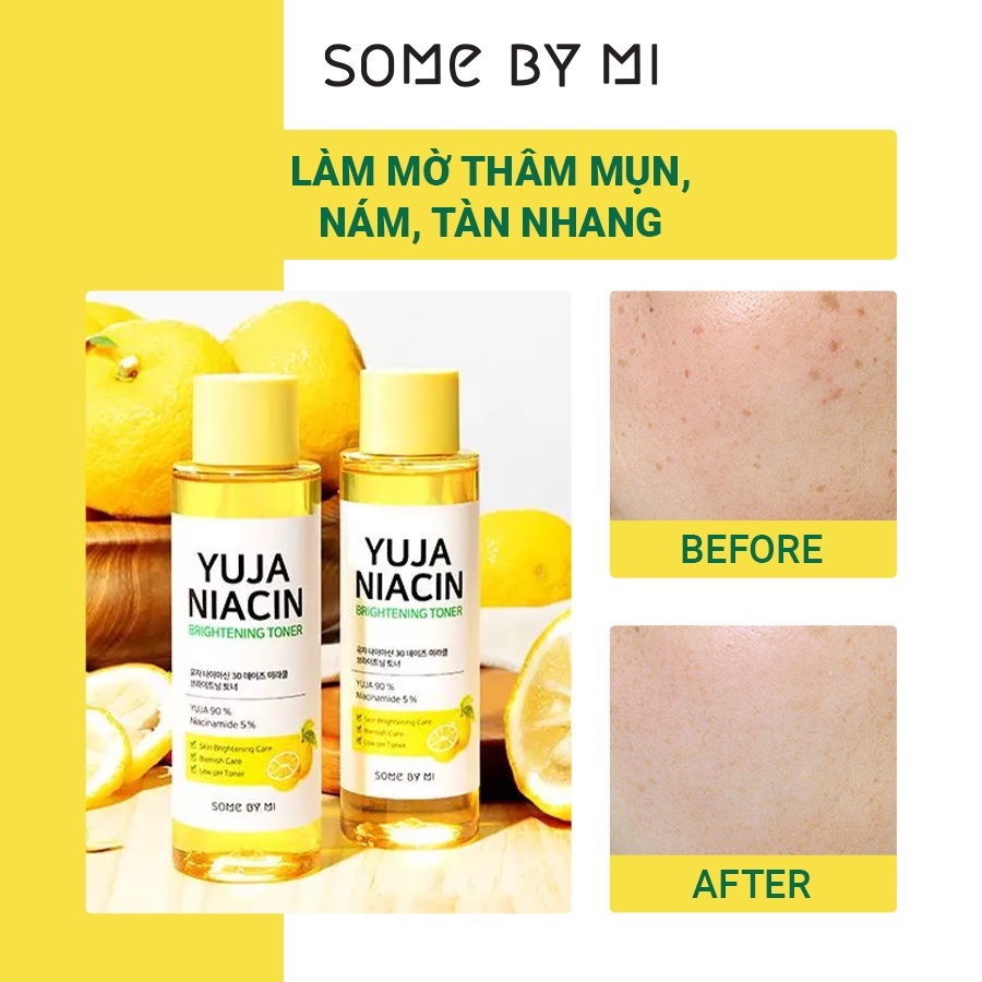 Nước Hoa Hồng Dưỡng Sáng Da SOME BY MI Yuja Niacin 30 Days Miracle Brightening Toner 150ml