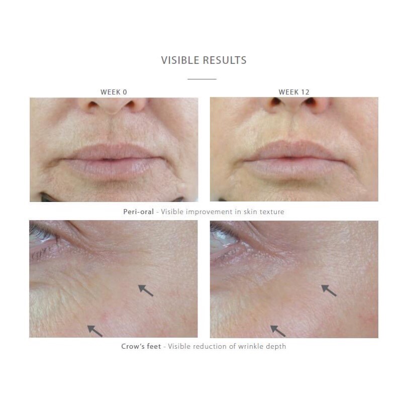 Kem dưỡng Medik8 R- Retinoate youth activating cream giảm nhăn giảm thâm giảm nám ngừa mụn