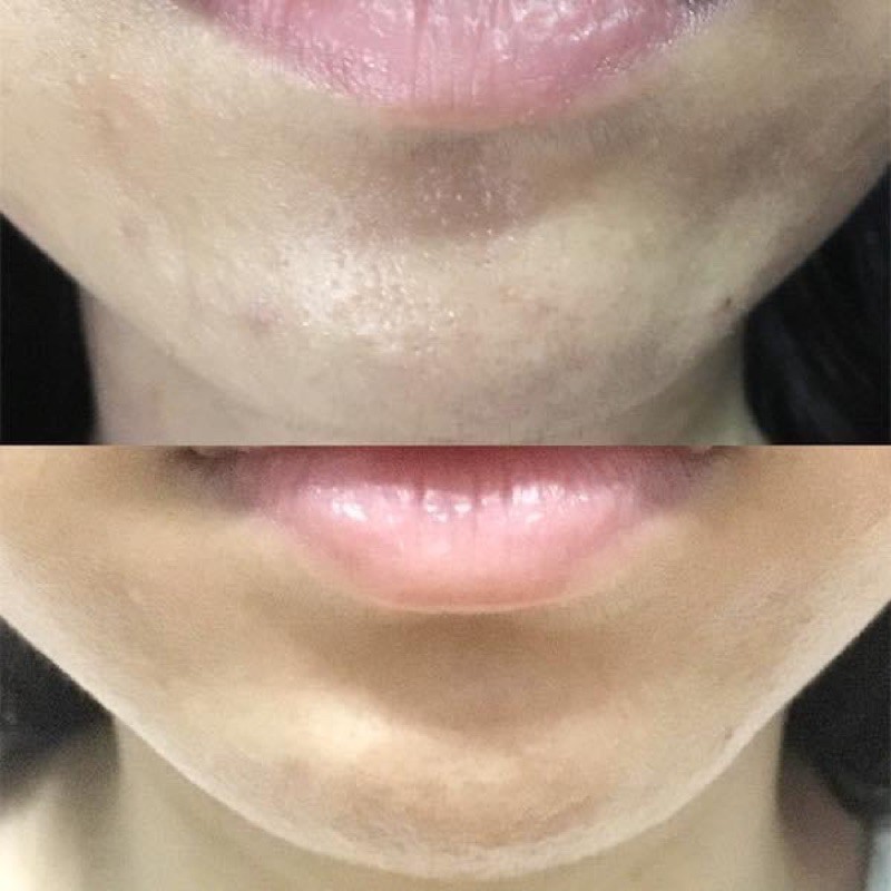 Tẩy da chết hoá học COSRX AHA 7 Whitehead Power Liquid [ Chính Hãng] | BigBuy360 - bigbuy360.vn