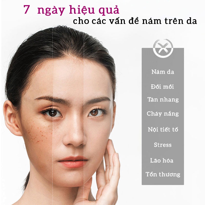 Kem dưỡng trắng da ngăn ngừa nám giảm nhăn giữ ẩm se khít lỗ chân lông OLY HT 35g