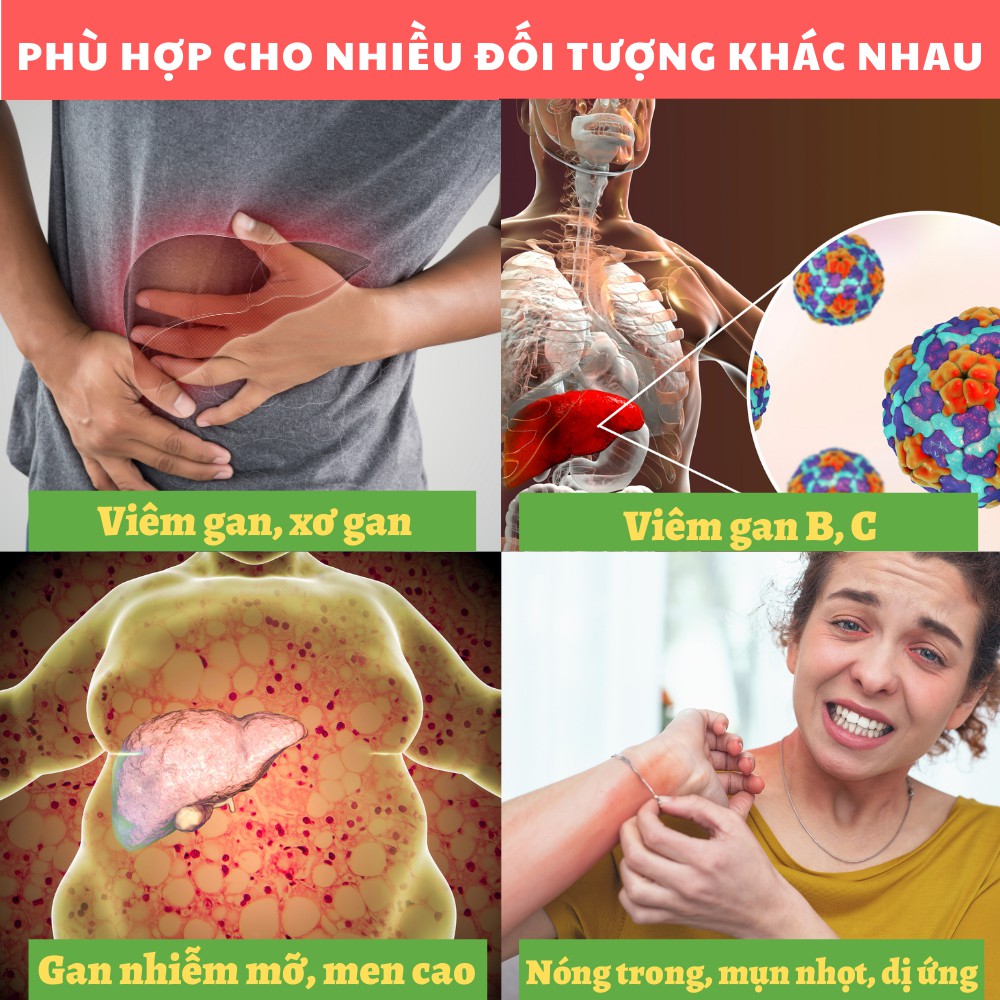 Cà Gai Leo Xạ Đen - Bổ Gan, Giải Độc Gan, Tăng Cường Chức Năng Gan (Hộp 60 Viên)