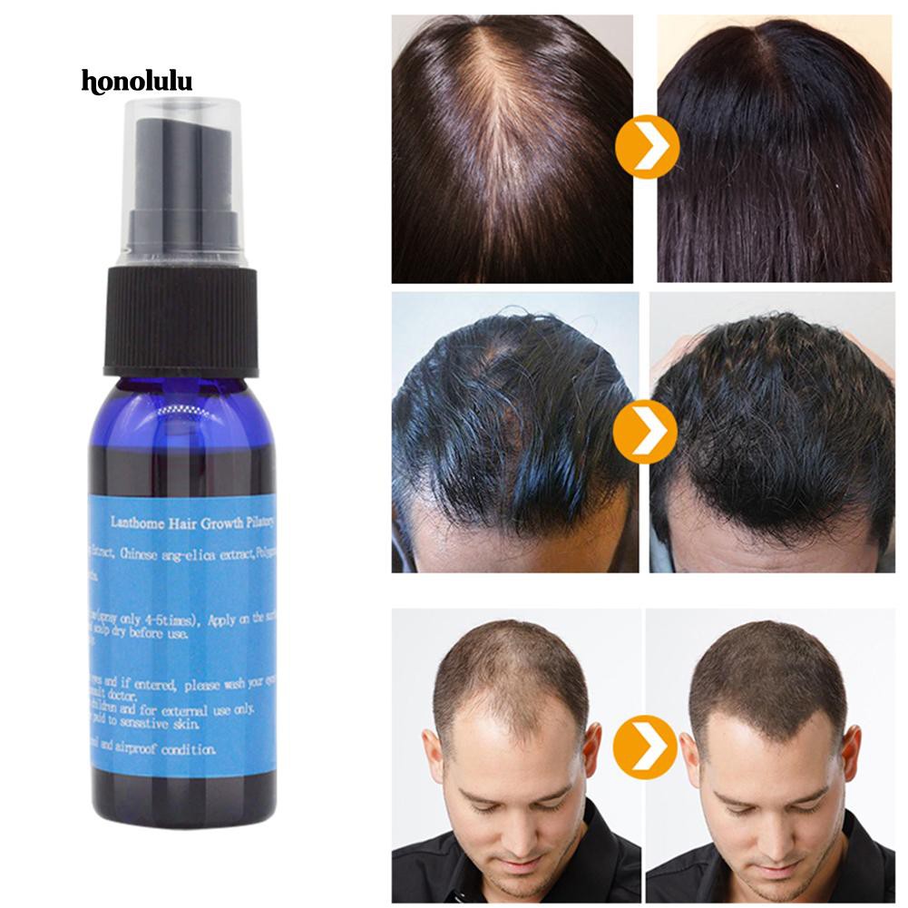 [Hàng mới về] Tinh chất kích thích mọc tóc chống rụng thể tích 30ml dành cho nam và nữ