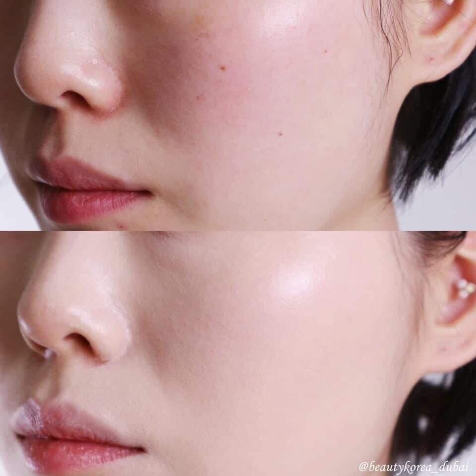 Kem Chống nắng SJM Medical Anti UV Perfect SunScreen SPF50++ 60ml