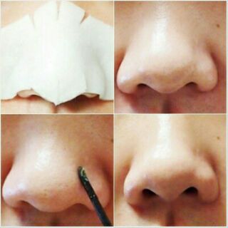 Lẻ Mặt Nạ Đẩy Mụn Good Bye Blackhead Ciracle