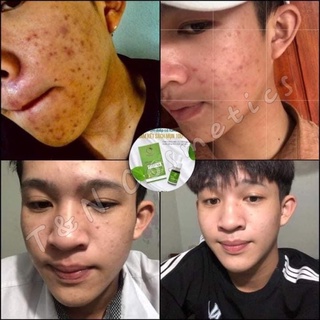 Serum diếp cá Igreen