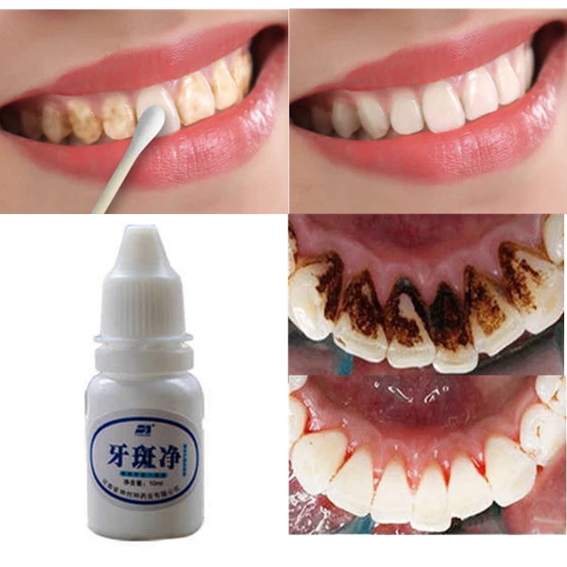 Bột Làm Trắng Răng Chất Lượng Cao