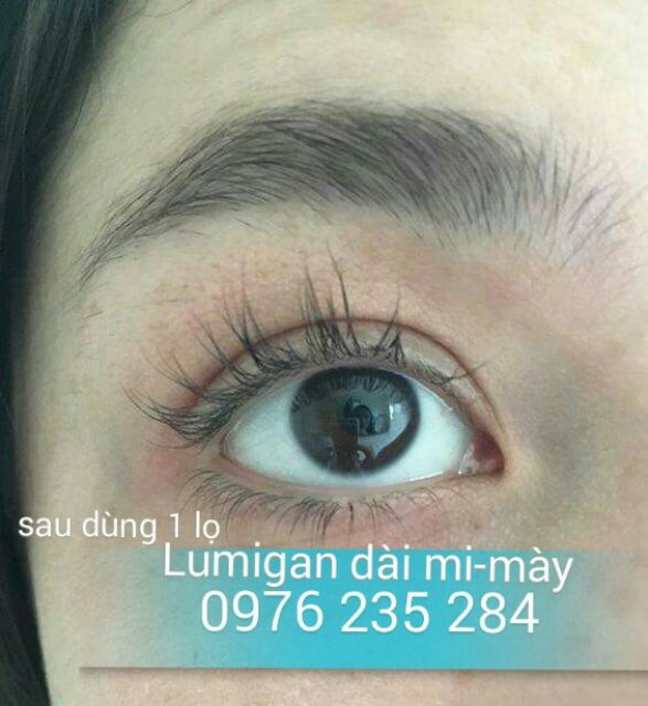 Lumigan Thuốc mọc dài mi của Mỹ | BigBuy360 - bigbuy360.vn