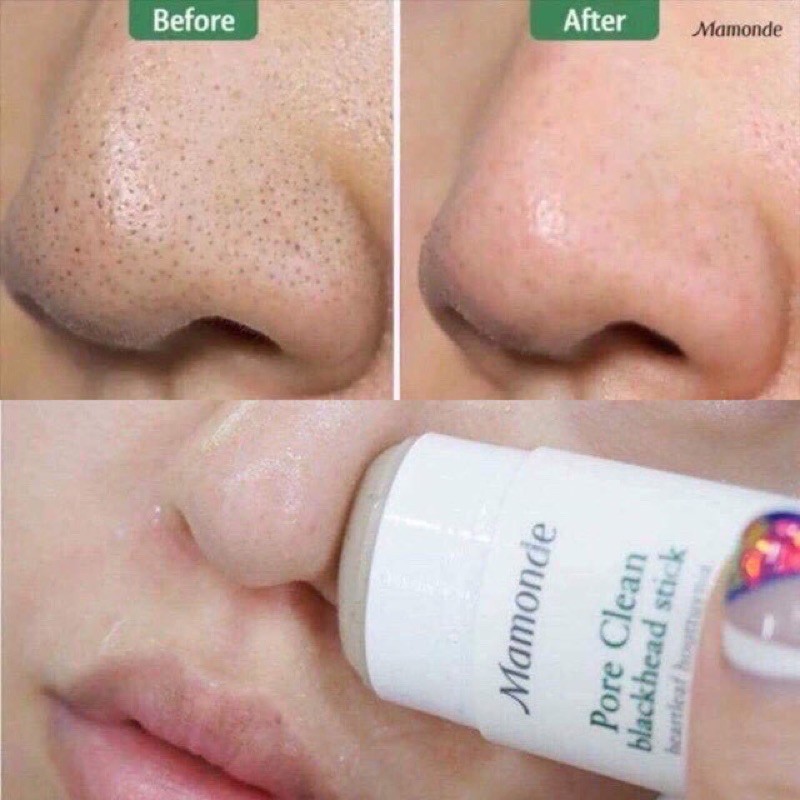 Thanh lăn mụn đầu đen Mamonde Pore clean Blackhead Stick