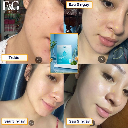 Combo 2 miếng mặt nạ giấy dưỡng da giảm quá trình lão hóa Retinol Mask E&amp;G từ tinh chất thiên nhiên giúp phục hồi da
