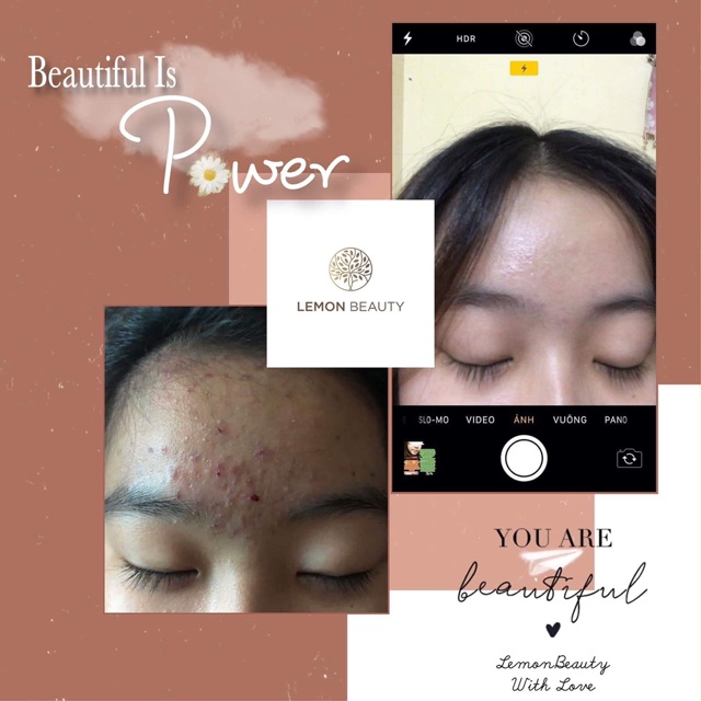 [MUA 1 TẶNG 4] - LEMON MASK KHỔ QUA RỪNG | BigBuy360 - bigbuy360.vn