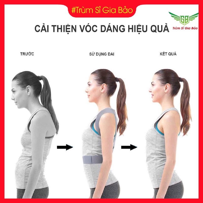Đai chống gù lưng nam nữ chính hãng, đai cho người lớn trẻ em thông minh tặng kèm 2 tấm trợ lực.