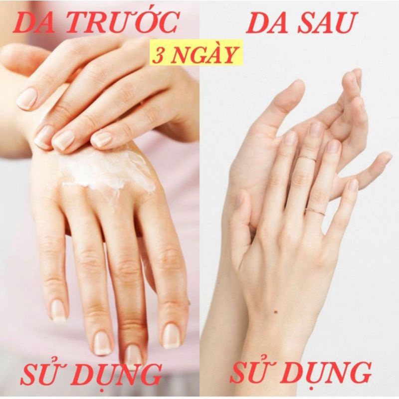 Kem body dưỡng trắng da alpha arbutin 3 hộp 200g